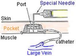 slide22