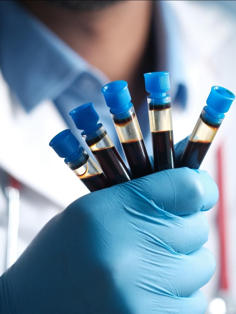 a medical professional, wearing latex gloves, is holding several sealed vials of bleed