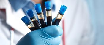 a medical professional, wearing latex gloves, is holding several sealed vials of bleed
