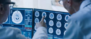 Doctors looking at brain scan
