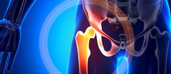 Bone Health and Hip