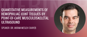 Quantitative measurements of hemophiliac joint tissues by point-of-care musculoskeletal ultrasound