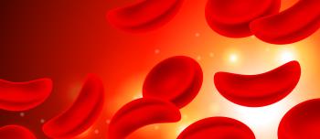 Sickle Cell
