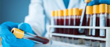 Takeda Announces Trial Results on Investigational Therapy for Ultra Rare Blood Disorder